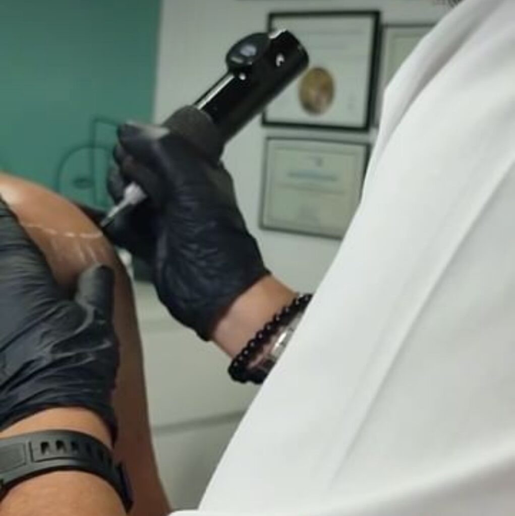 Tratamiento contra la alopecia capilar