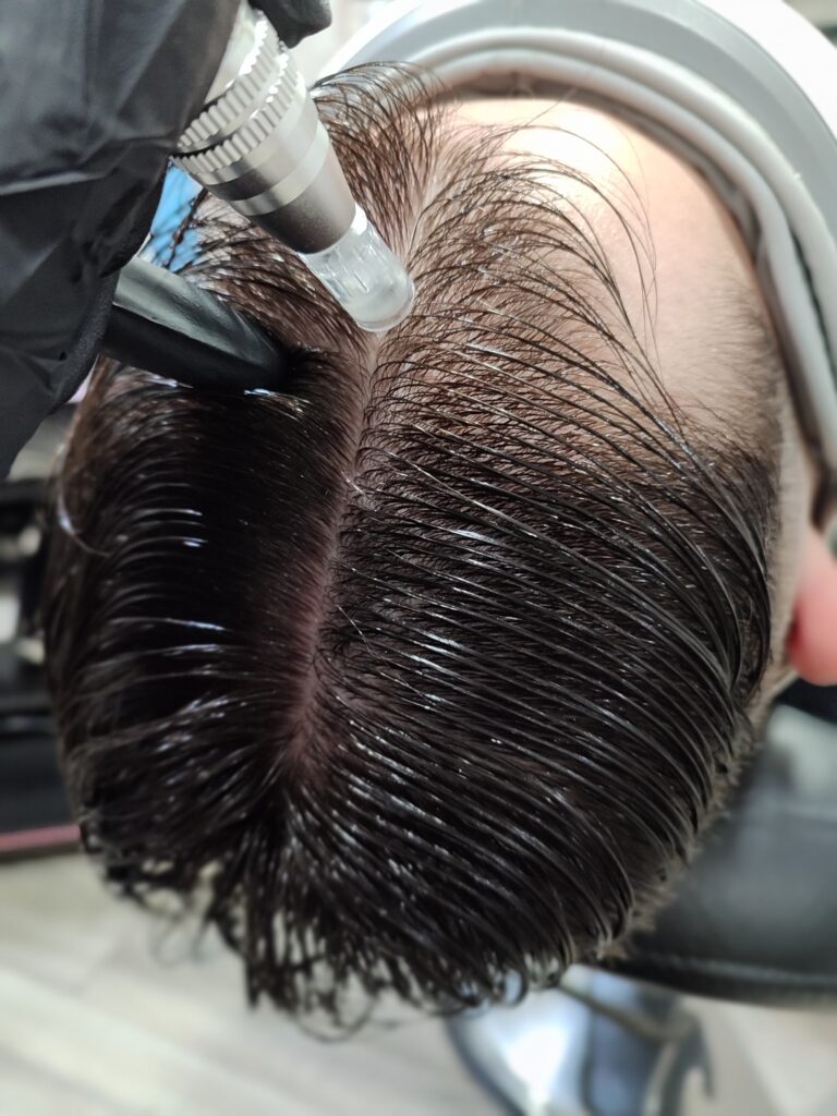 Diagnóstico capilar en hombres